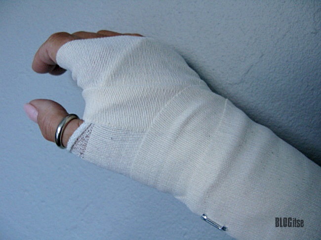 my wrist splint by BLOGitse